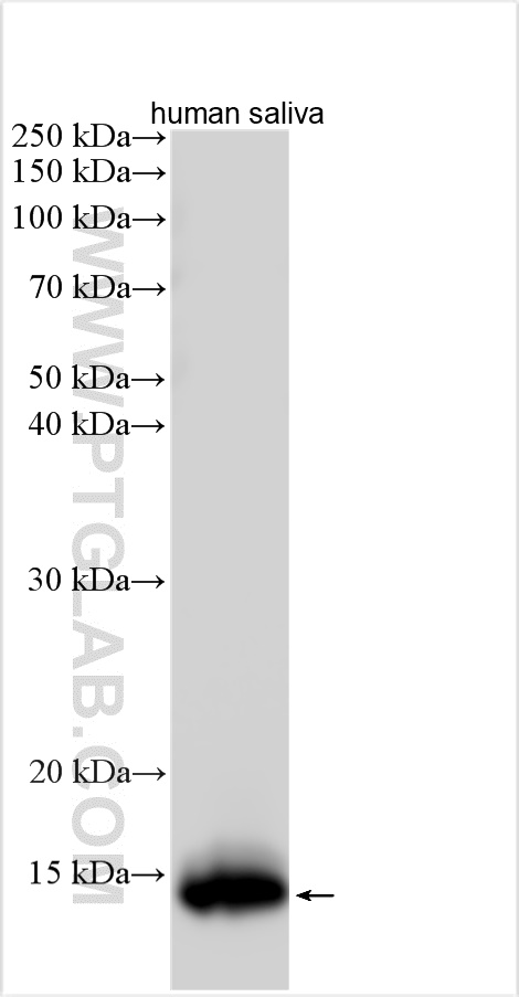 WB analysis using 30988-1-AP