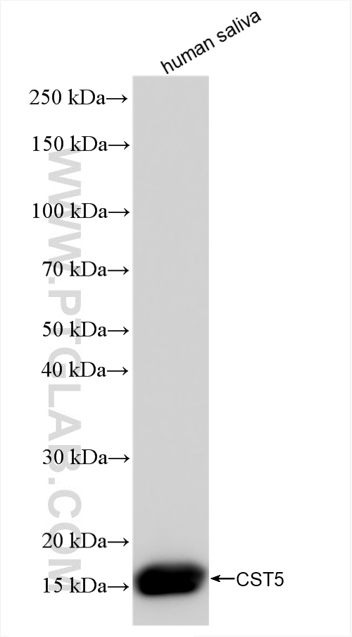WB analysis of human saliva using 84678-4-RR (same clone as 84678-4-PBS)