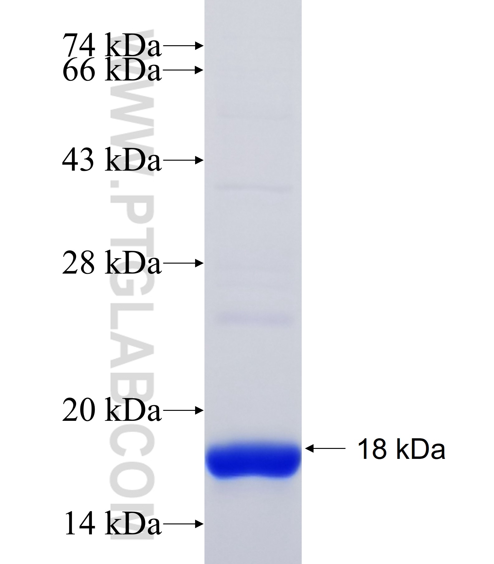 CST5 fusion protein Ag34425 SDS-PAGE