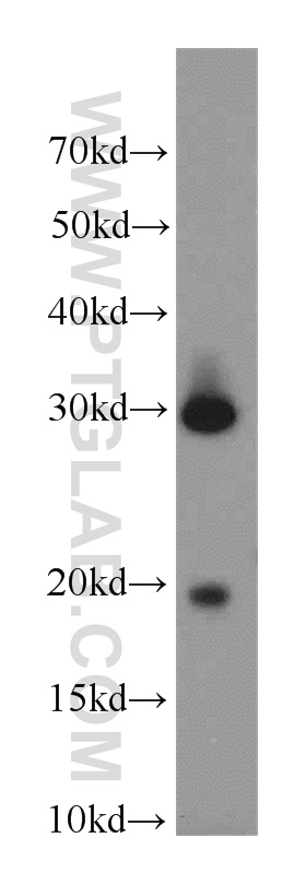 WB analysis of human testis using 18183-1-AP