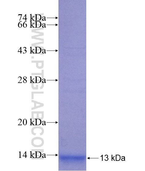 CST9 fusion protein Ag19689 SDS-PAGE