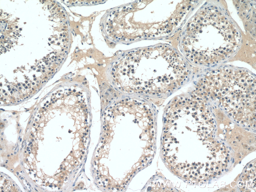 IHC staining of human testis using 13649-1-AP