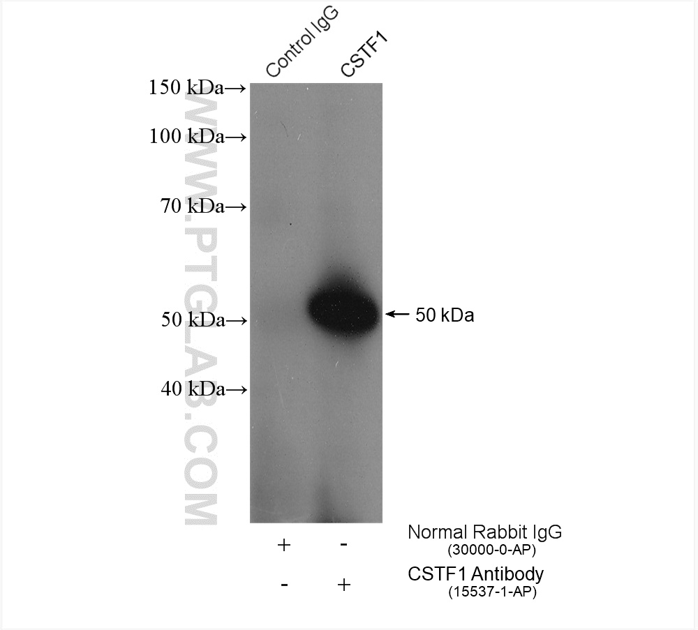 IP experiment of HeLa using 15537-1-AP