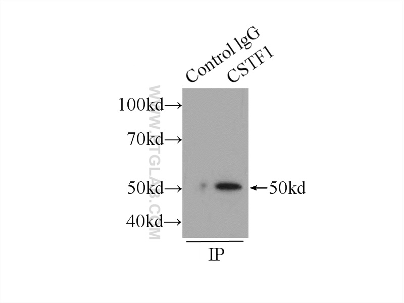 CSTF1