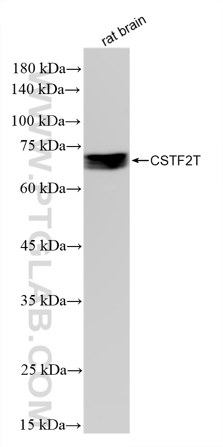 WB analysis of rat brain using 88063-1-RR (same clone as 88063-1-PBS) WB analysis of rat brain using 88063-1-RR (same clone as 88063-1-PBS)