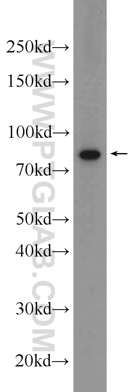 CSTF3