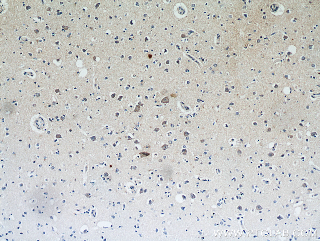 IHC staining of human brain using 21143-1-AP