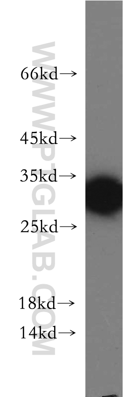 WB analysis of HepG2 using 21143-1-AP