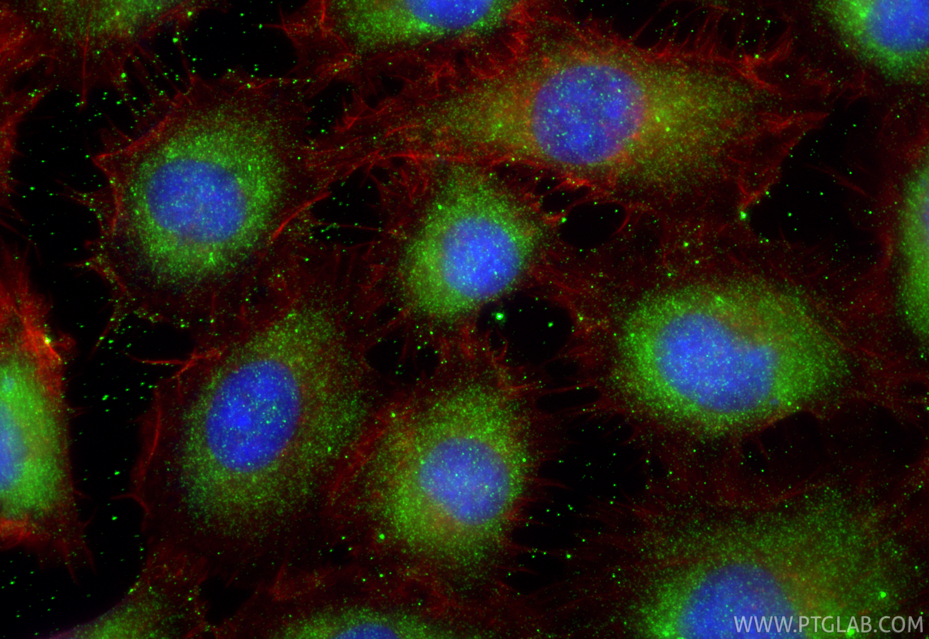 IF Staining of HT-1080 using 19521-1-AP IF Staining of HT-1080 using 19521-1-AP