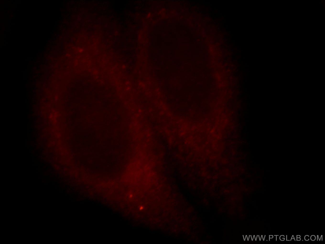 IF Staining of HepG2 using 19521-1-AP