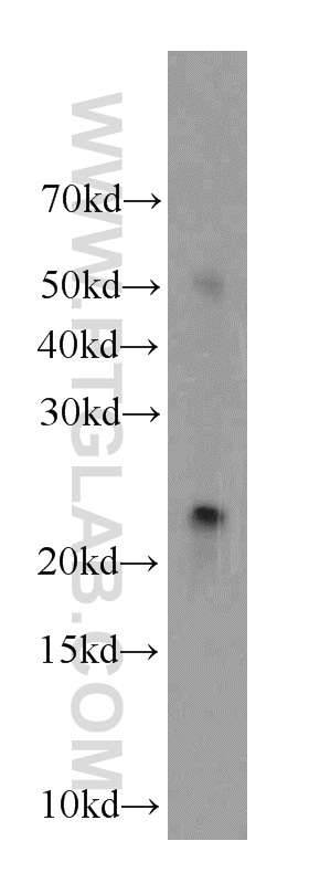 WB analysis of human testis using 19521-1-AP