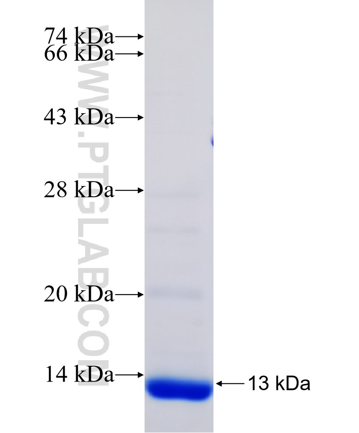 CTAG1B fusion protein Ag18967 SDS-PAGE CTAG1B fusion protein Ag18967 SDS-PAGE