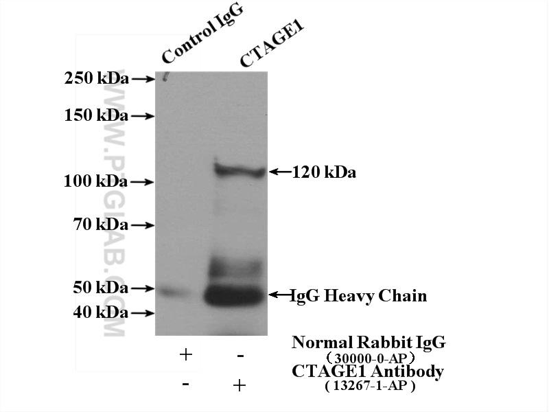 IP experiment of HeLa using 13267-1-AP