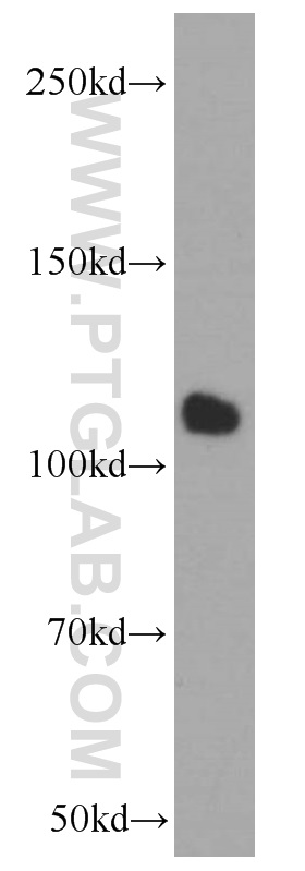 WB analysis of HeLa using 60087-1-Ig