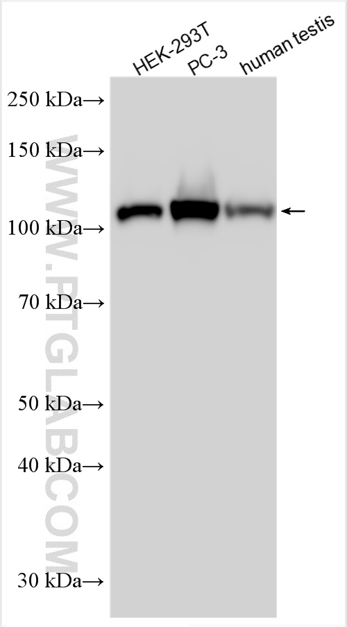 WB analysis using 55279-1-AP