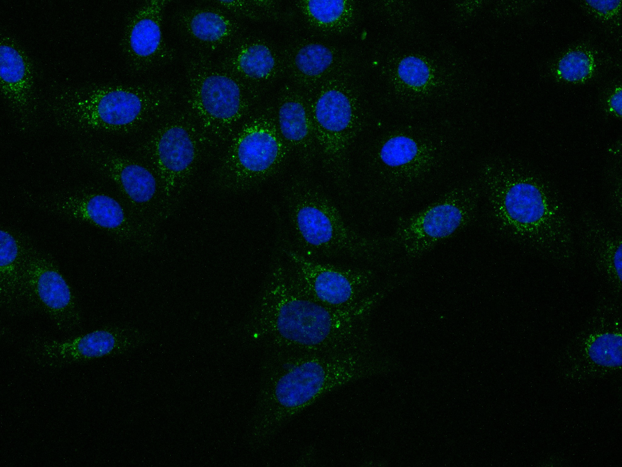 IF Staining of HepG2 using 83017-2-RR (same clone as 83017-2-PBS)