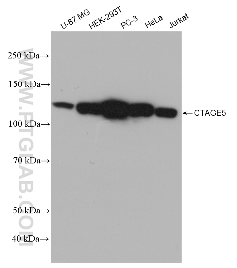 WB analysis using 83017-2-RR (same clone as 83017-2-PBS)