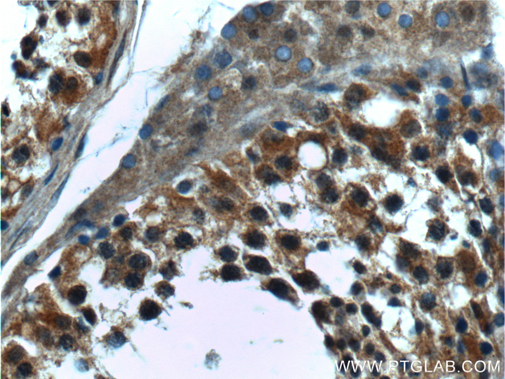 IHC staining of human testis using 17438-1-AP