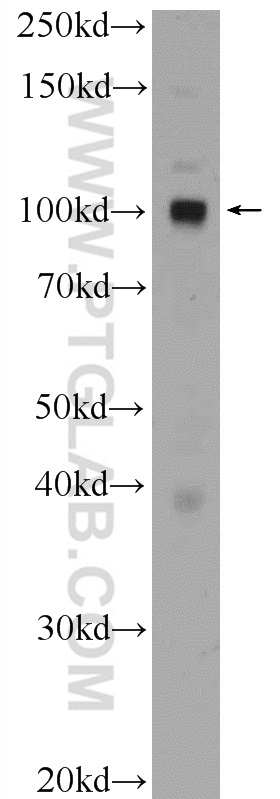 WB analysis of HeLa using 17438-1-AP