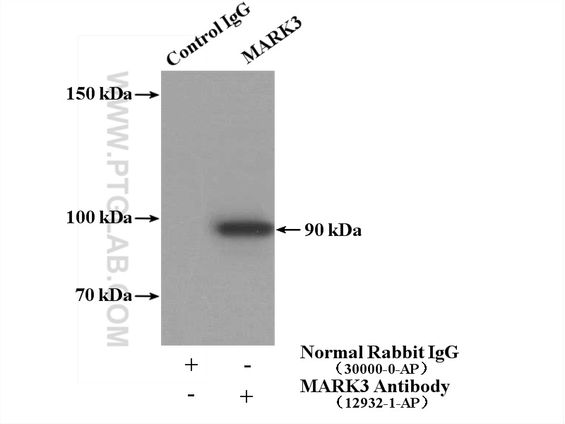 IP experiment of mouse brain using 12932-1-AP