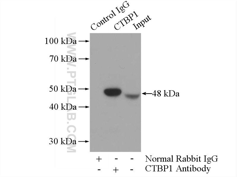 IP experiment of mouse brain using 10972-1-AP