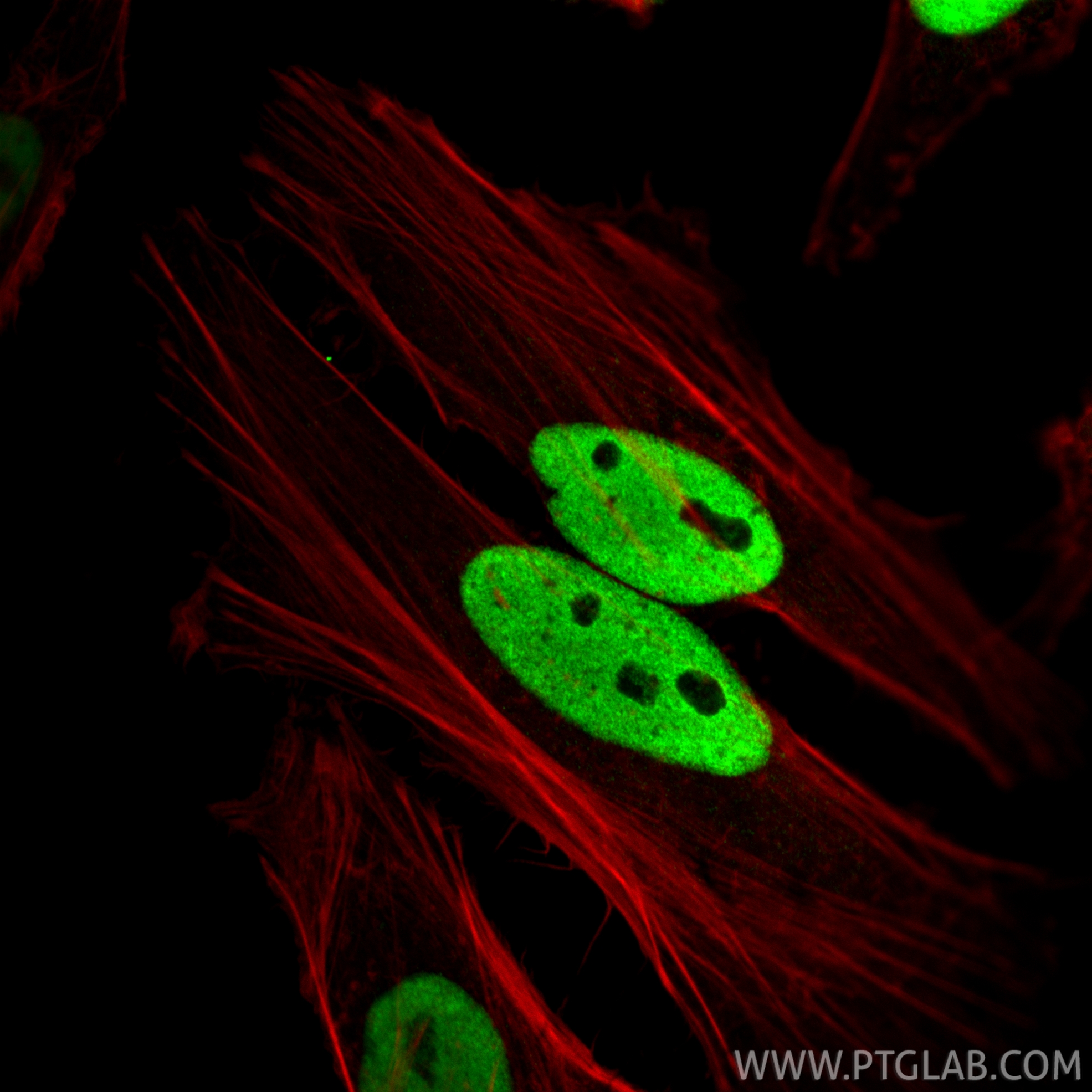 IF Staining of HeLa using 66995-1-Ig IF Staining of HeLa using 66995-1-Ig