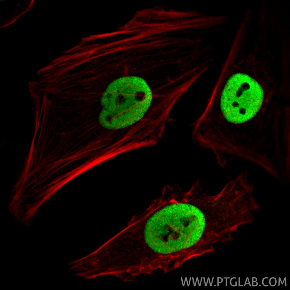 IF Staining of HeLa using CL488-66995 IF Staining of HeLa using CL488-66995