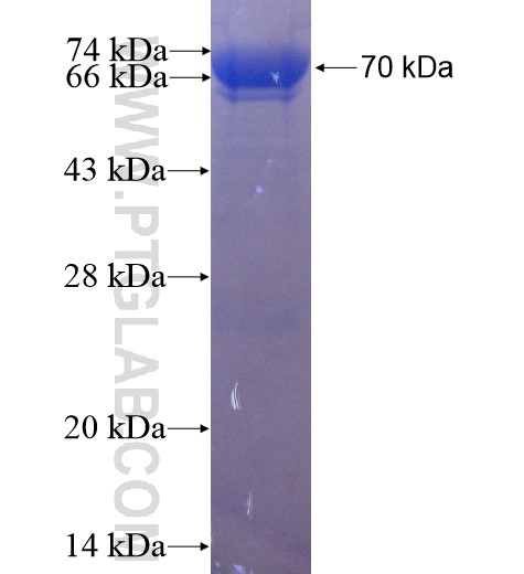 CTBP1 fusion protein Ag1425 SDS-PAGE