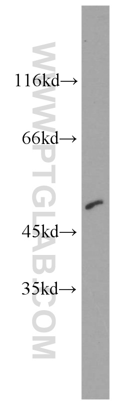 CTBP2 Polyclonal antibody