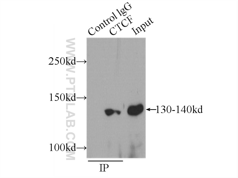 IP experiment of MCF-7 using 10915-1-AP