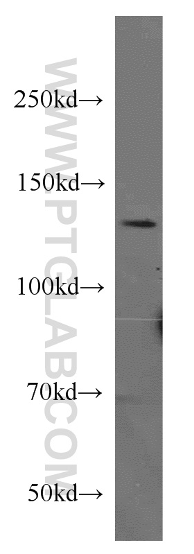 CTCF Polyclonal antibody