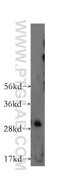 WB analysis of human kidney using 11116-1-AP