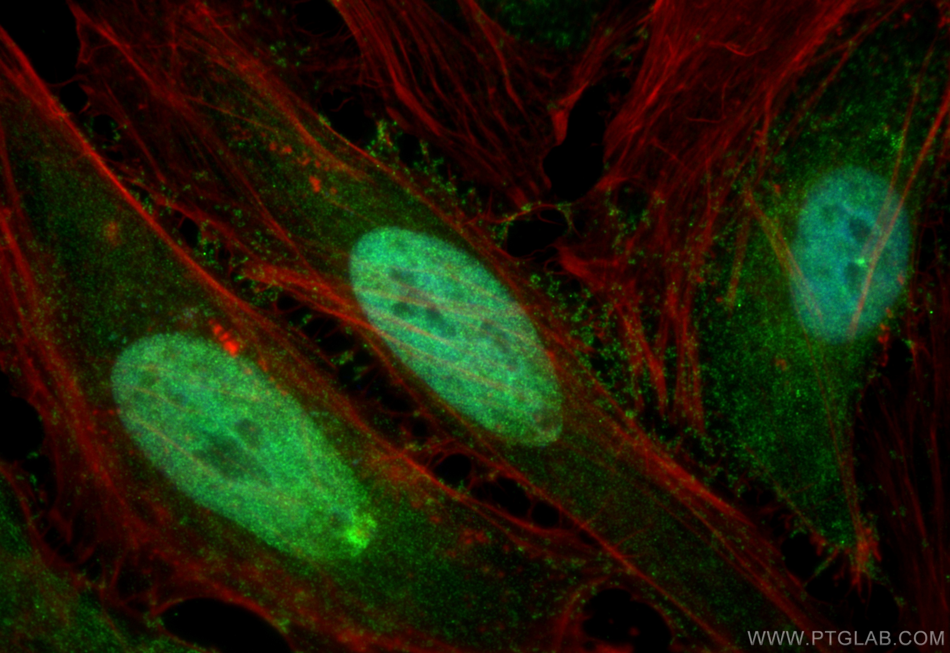 IF Staining of HeLa using 17532-1-AP