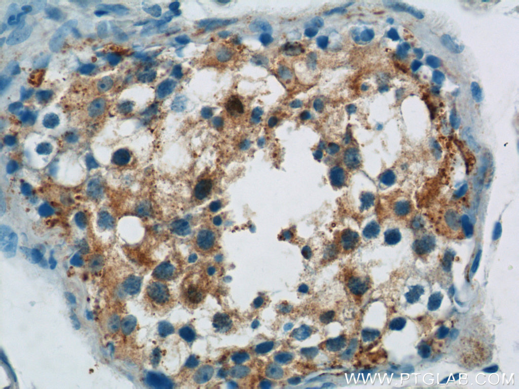 IHC staining of human testis using 17532-1-AP