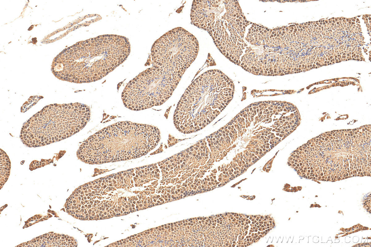 IHC staining of mouse testis using 17532-1-AP (same clone as 17532-1-PBS)