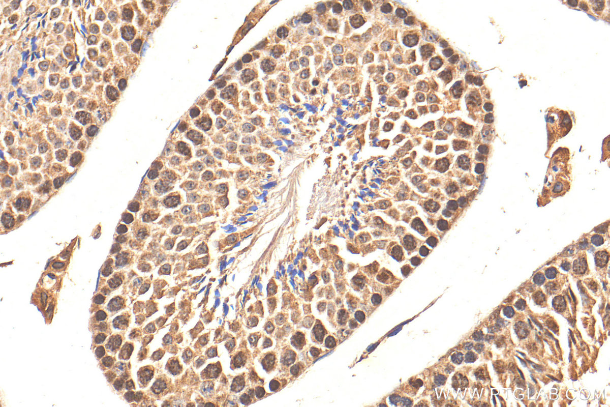 IHC staining of mouse testis using 17532-1-AP (same clone as 17532-1-PBS)