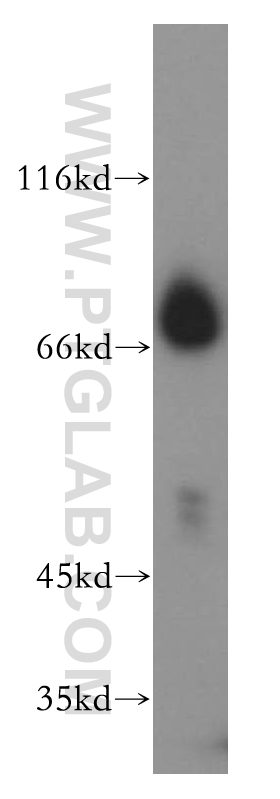 WB analysis of MCF-7 using 17532-1-AP