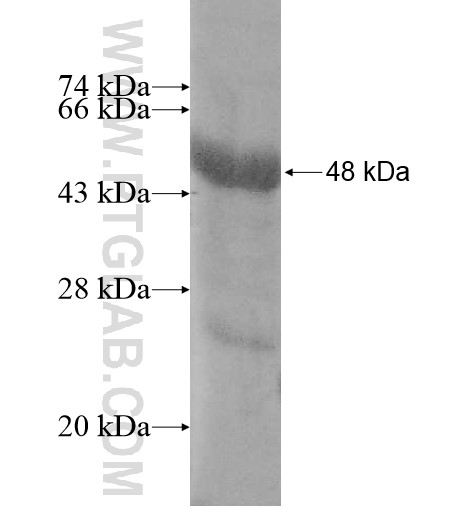 CTDSPL2 fusion protein Ag11346 SDS-PAGE CTDSPL2 fusion protein Ag11346 SDS-PAGE