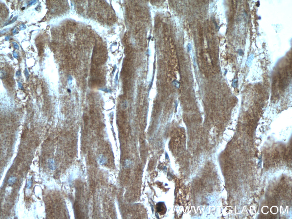 IHC staining of human heart using 17518-1-AP