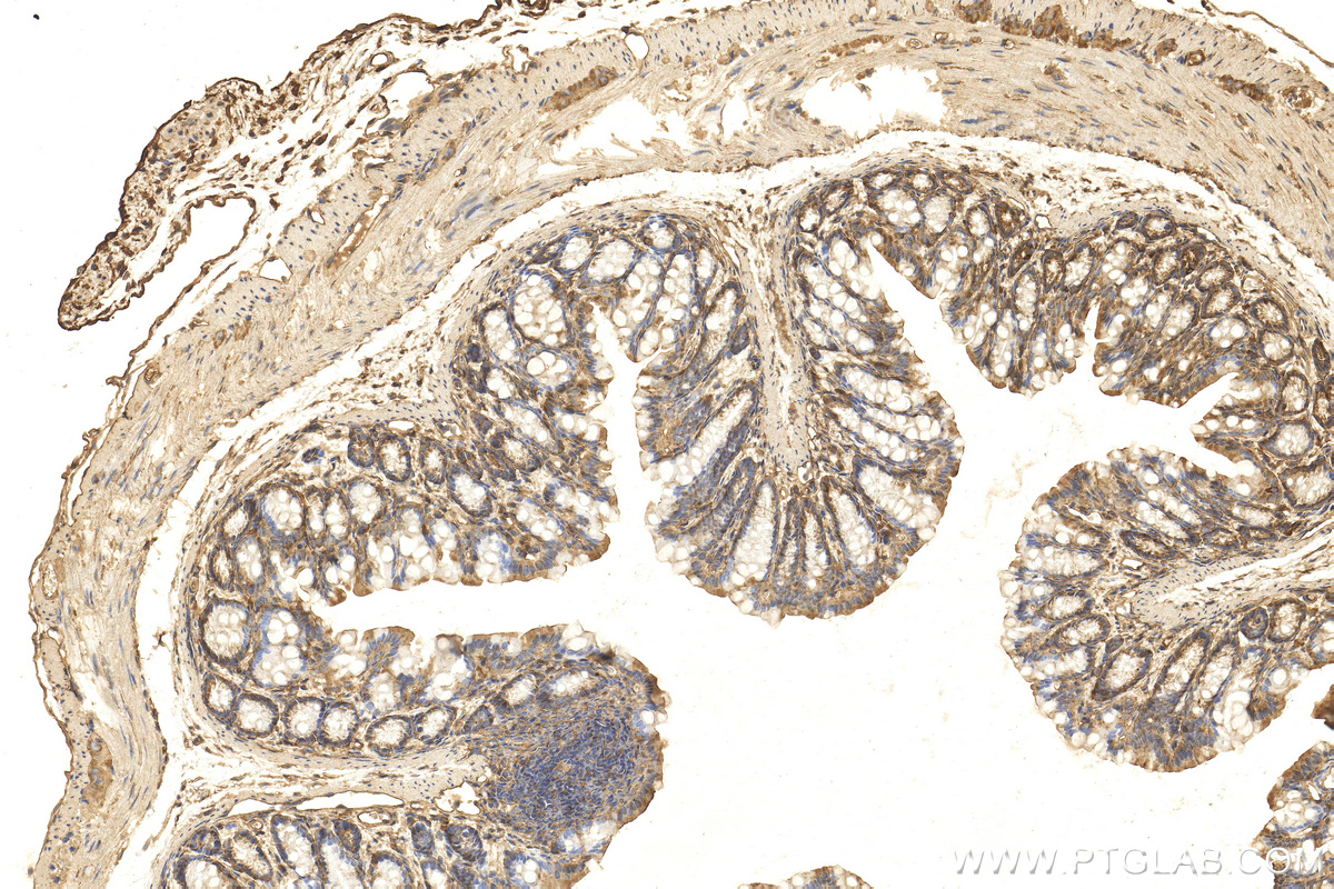 IHC staining of mouse colon using 25474-1-AP