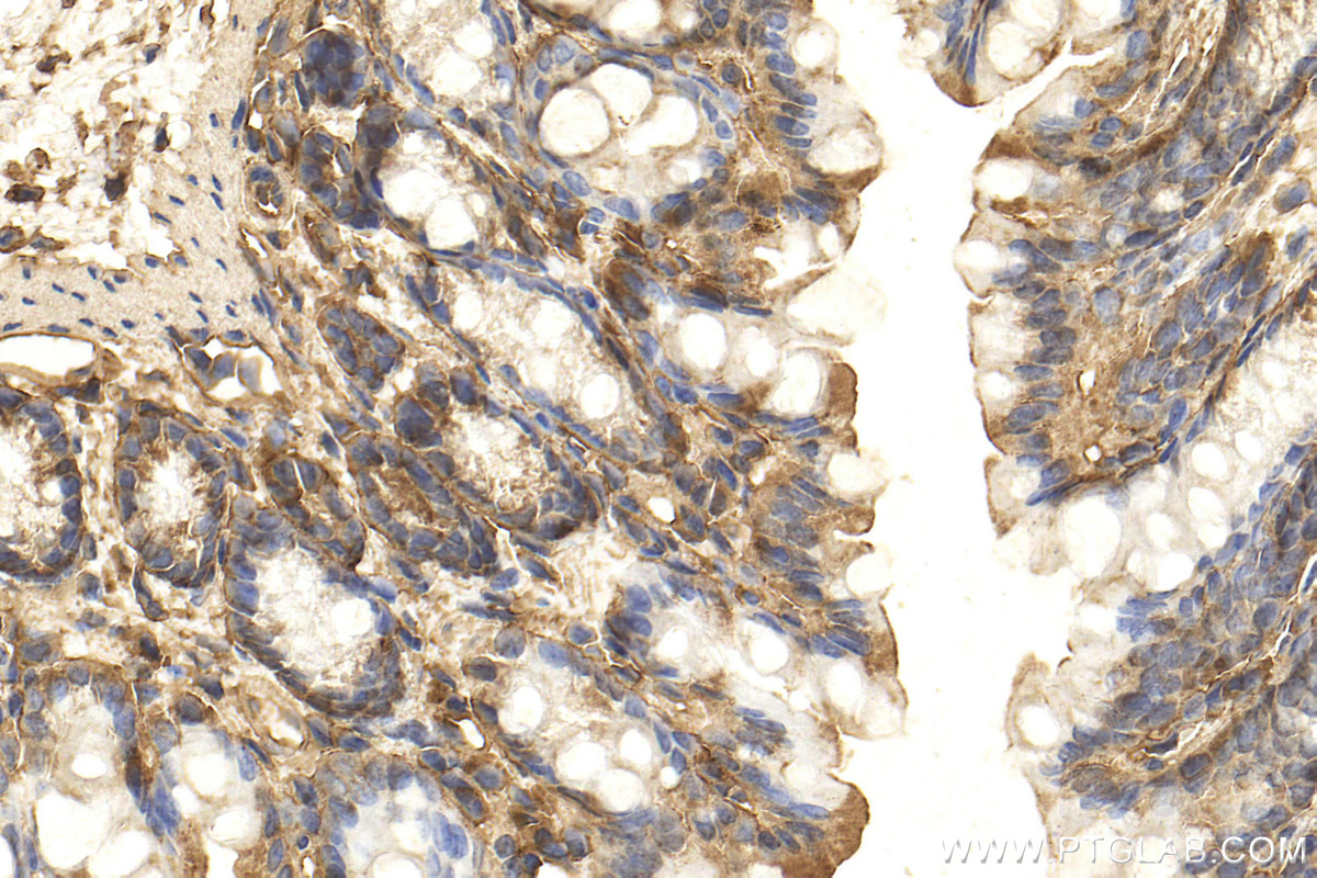 IHC staining of mouse colon using 25474-1-AP