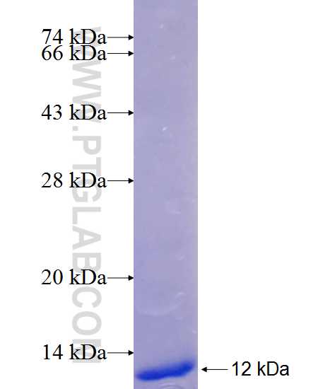 CTGF fusion protein Ag21018 SDS-PAGE