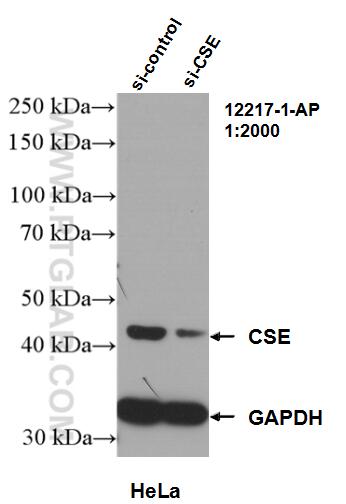 WB analysis of HeLa using 12217-1-AP