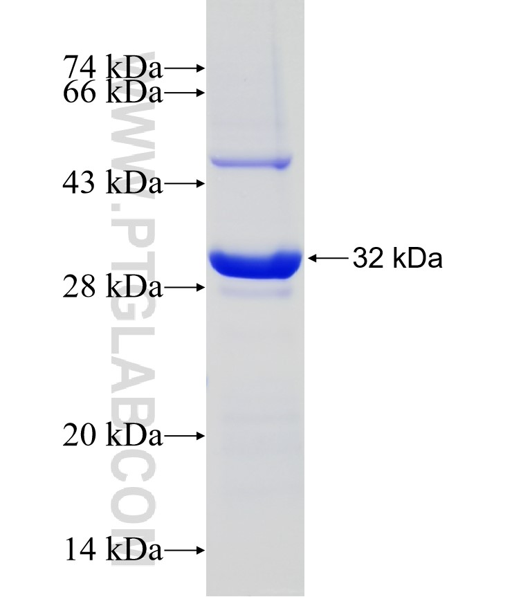 CTHRC1 fusion protein Ag9812 SDS-PAGE