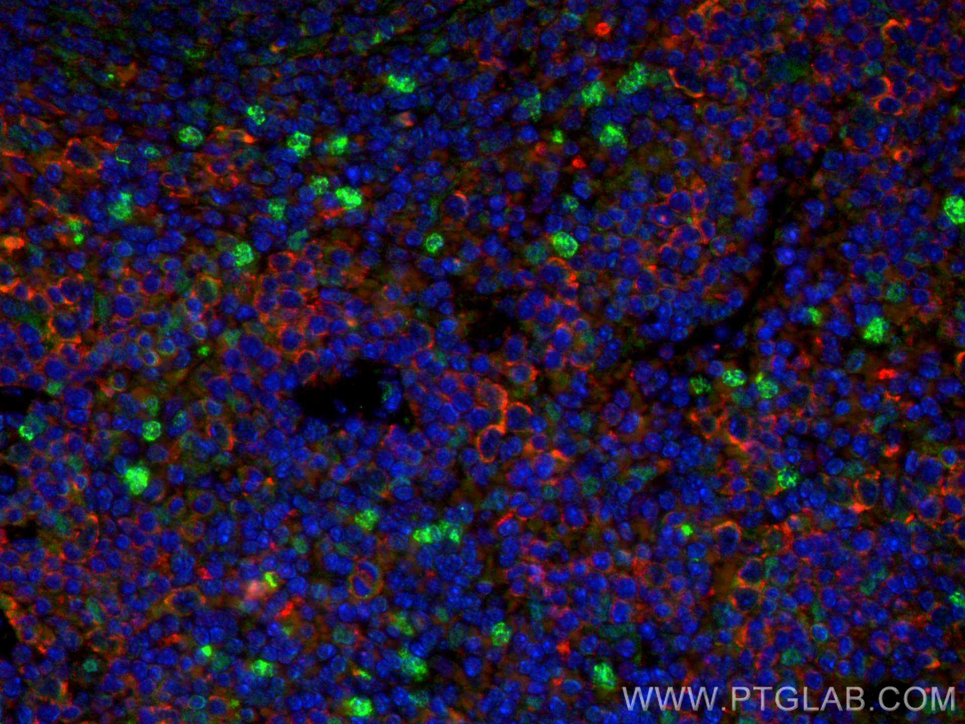 IF Staining of mouse spleen using 30648-1-AP