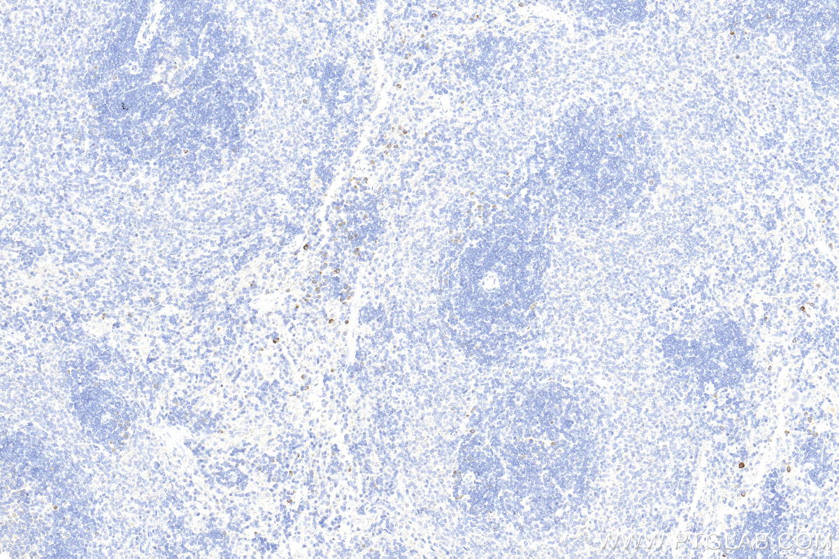 IHC staining of rat spleen using 30648-1-AP