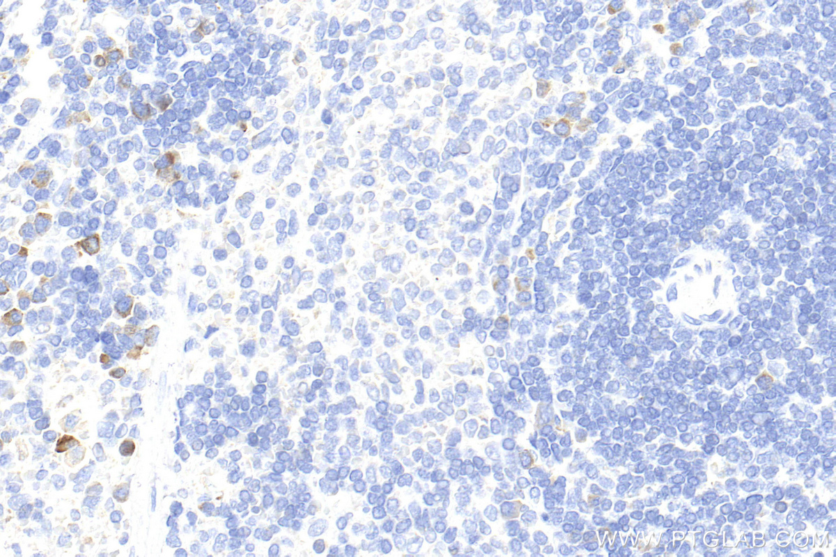 IHC staining of rat spleen using 30648-1-AP