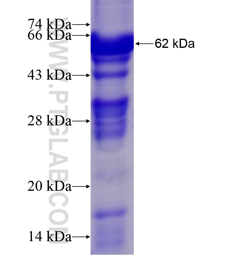 CTLA4 fusion protein Ag10548 SDS-PAGE CTLA4 fusion protein Ag10548 SDS-PAGE