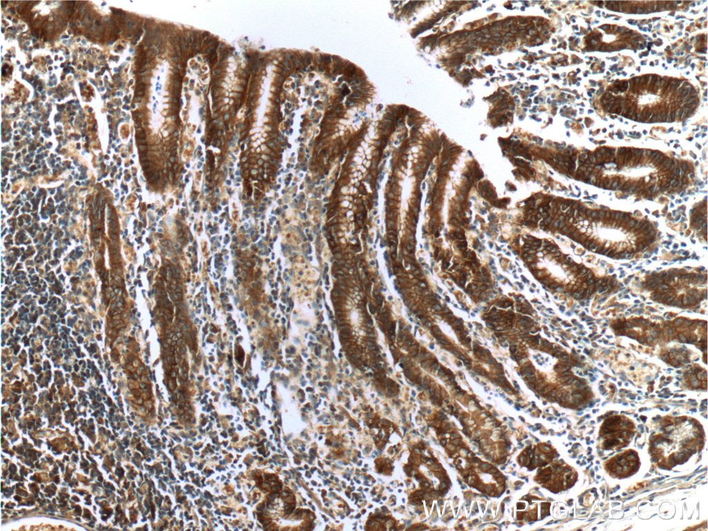 IHC staining of human stomach using 66221-1-Ig (same clone as 66221-1-PBS)