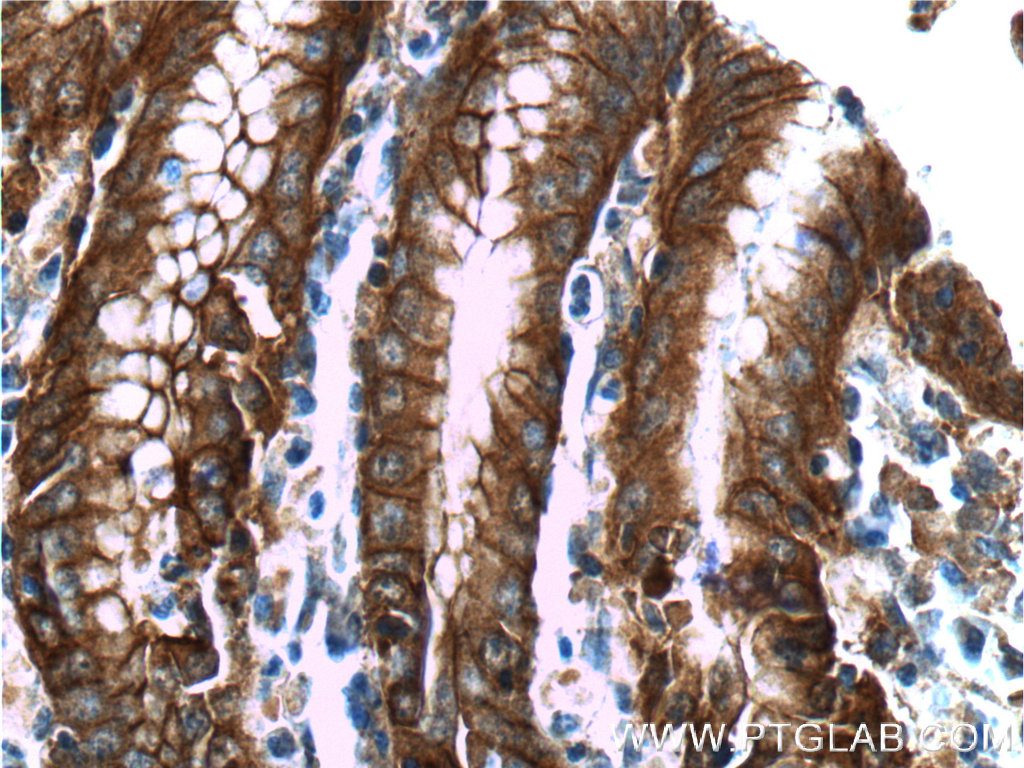 Alpha E-Catenin Monoclonal antibody